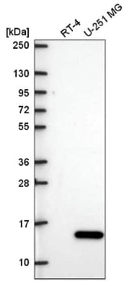 ICAP-1 Antibody, Novus Biologicals 25 &mu;L, Unlabeled:Antibodies, Polyclonal