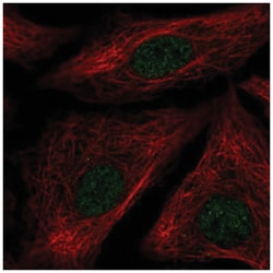 ID1 Antibody, Novus Biologicals:Antibodies:Primary Antibodies