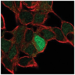 ID4 Antibody, Novus Biologicals 25 &mu;L, Unlabeled:Antibodies, Polyclonal