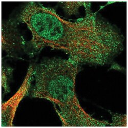 IFFO2 Antibody, Novus Biologicals 25 &mu;L, Unlabeled:Antibodies, Polyclonal