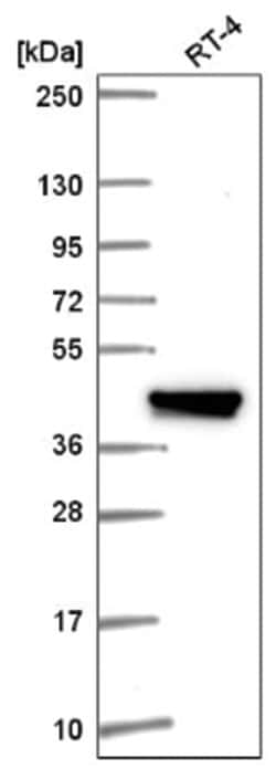 IFIT5 Antibody, Novus Biologicals:Antibodies:Primary Antibodies