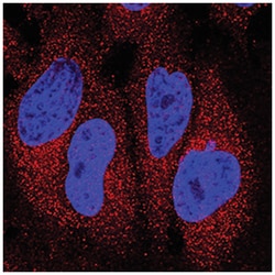 Human IFN-alpha 2/IFNA2 Antibody, R D Systems:Antibodies:Primary Antibodies