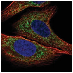 IGFBP-2 Antibody, Novus Biologicals:Antibodies:Primary Antibodies