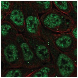 IKB zeta Antibody, Novus Biologicals 25 &mu;L, Unlabeled:Antibodies, Polyclonal