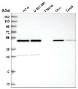 IKIP Antibody, Novus Biologicals 100&mu;L; Unlabeled:Antibodies, Polyclonal