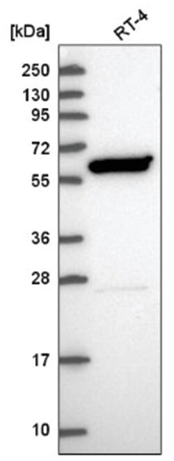 ZNFN1A4 Antibody, Novus Biologicals:Antibodies:Primary Antibodies