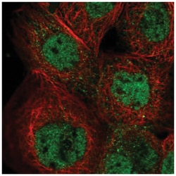IKZF5 Antibody, Novus Biologicals 25 &mu;L, Unlabeled:Antibodies, Polyclonal