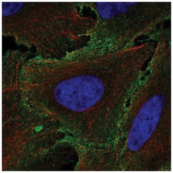 IL-12 R beta 1 Antibody, Novus Biologicals 25 &mu;L, Unlabeled:Antibodies,