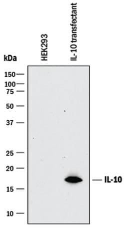 Human IL-10 Antibody, R D Systems:Antibodies:Primary Antibodies