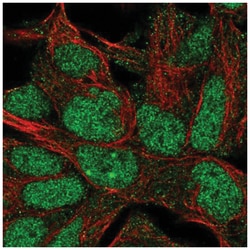 IMP3 Antibody, Novus Biologicals 100&mu;L; Unlabeled:Antibodies, Polyclonal