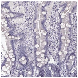 IMPG1 Antibody, Novus Biologicals:Antibodies:Primary Antibodies
