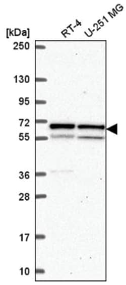 Importin alpha 5/KPNA1/SRP1 Antibody, Novus Biologicals 100&mu;L; Unlabeled:Antibodies,