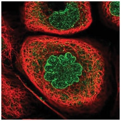 Importin beta/KPNB1 Antibody, Novus Biologicals 25 &mu;L:Antibodies, Polyclonal