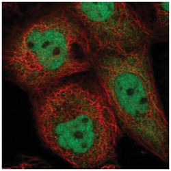 ING1 Antibody, Novus Biologicals:Antibodies:Primary Antibodies