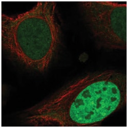 ING4 Antibody, Novus Biologicals:Antibodies:Primary Antibodies