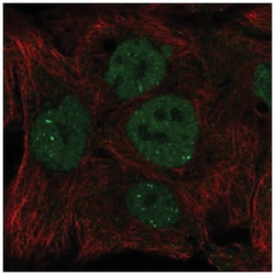 INO80 Antibody, Novus Biologicals 25 &mu;L; Unlabeled:Antibodies, Polyclonal