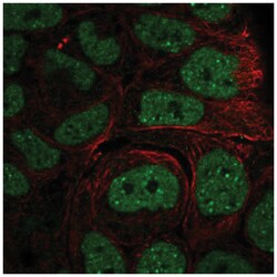 INO80 Antibody, Novus Biologicals 25 &mu;L; Unlabeled:Antibodies, Polyclonal