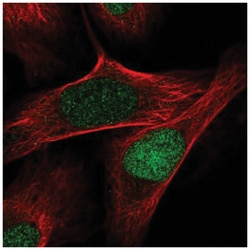 Intron-Binding Protein Of 160 KDa Antibody, Novus Biologicals 25 &mu;L:Antibodies,