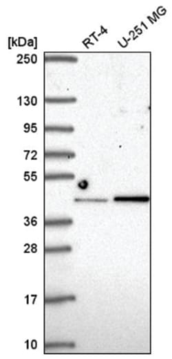 IRF2 Antibody, Novus Biologicals:Antibodies:Primary Antibodies
