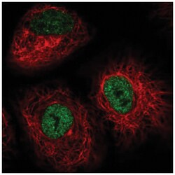 IRF2BP2 Antibody, Novus Biologicals 25 &mu;L, Unlabeled:Antibodies, Polyclonal