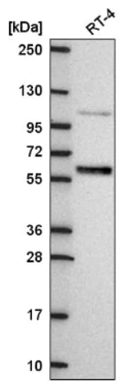 IRF6 Antibody, Novus Biologicals:Antibodies:Primary Antibodies