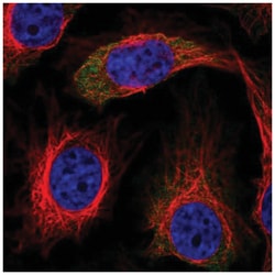 IRS2 Antibody, Novus Biologicals 100&mu;L; Unlabeled:Antibodies, Polyclonal