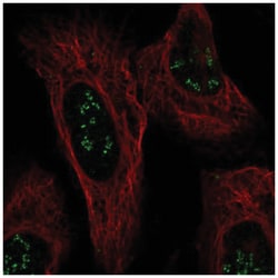 ISPD Antibody, Novus Biologicals:Antibodies:Primary Antibodies