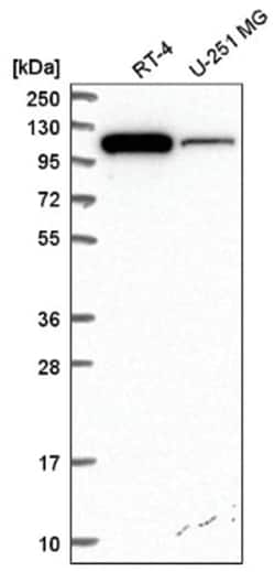 ITCH/AIP4 Antibody, Novus Biologicals:Antibodies:Primary Antibodies