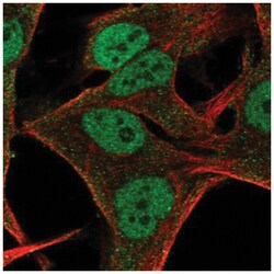 ITGB1BP3 Antibody, Novus Biologicals:Antibodies:Primary Antibodies