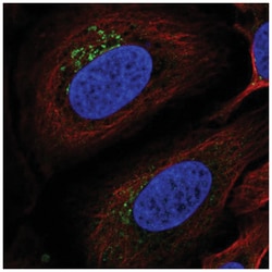 ITM2B Antibody, Novus Biologicals 25 &mu;L, Unlabeled:Antibodies, Polyclonal