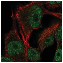 ITPKB Antibody, Novus Biologicals 25 &mu;L, Unlabeled:Antibodies, Polyclonal