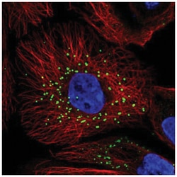 Jagged 2 Antibody, Novus Biologicals:Antibodies:Primary Antibodies