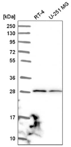 JAM-C Antibody, Novus Biologicals 100&mu;L; Unlabeled:Antibodies, Polyclonal