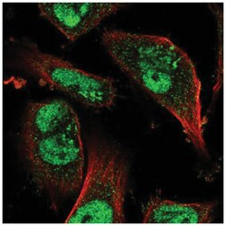 JMJD1B Antibody, Novus Biologicals 25 &mu;L, Unlabeled:Antibodies, Polyclonal