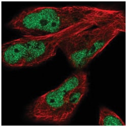JMJD1C Antibody, Novus Biologicals:Antibodies:Primary Antibodies