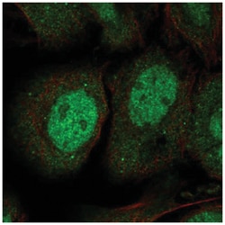 JPH3 Antibody, Novus Biologicals 100&mu;L; Unlabeled:Antibodies, Polyclonal