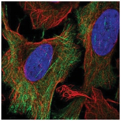 KCNN1 Antibody, Novus Biologicals 25 &mu;L, Unlabeled:Antibodies, Polyclonal