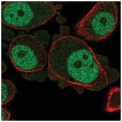 KCNN3 Antibody, Novus Biologicals 25 &mu;L:Antibodies, Polyclonal