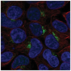 KCT2 Antibody, Novus Biologicals:Antibodies:Primary Antibodies