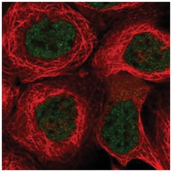 KCTD9 Antibody, Novus Biologicals:Antibodies:Primary Antibodies