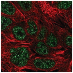 KDELC2 Antibody, Novus Biologicals 25 &mu;L, Unlabeled:Antibodies, Polyclonal