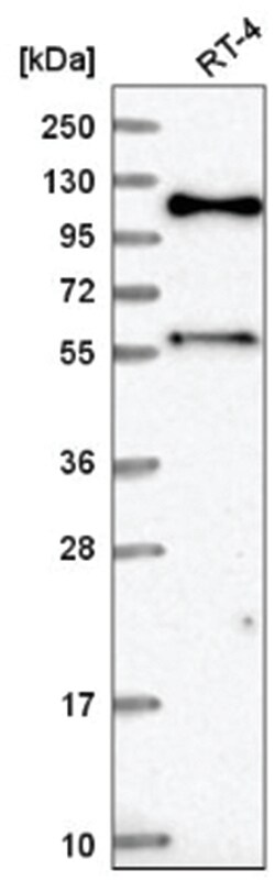 SPIDR Antibody, Novus Biologicals:Antibodies:Primary Antibodies