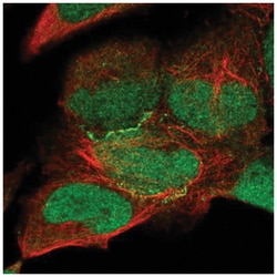 KIAA0895 Antibody, Novus Biologicals 100&mu;L; Unlabeled:Antibodies, Polyclonal