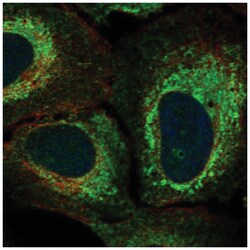 KIAA1324L Antibody, Novus Biologicals 25 &mu;L; Unconjugated:Antibodies,