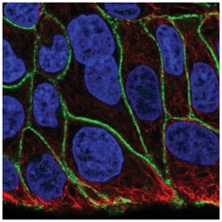 KIAA1522 Antibody, Novus Biologicals 25 &mu;L | Buy Online | Novus Biologicals | Fisher Scientific