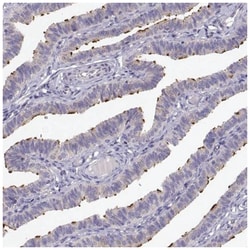 KIF19 Antibody, Novus Biologicals 100&mu;L; Unlabeled:Antibodies, Polyclonal