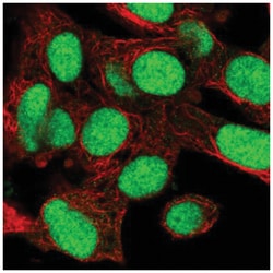 KIN Antibody, Novus Biologicals 25 &mu;L, Unlabeled:Antibodies, Polyclonal