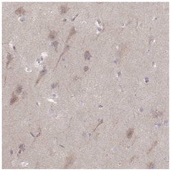 Kir3.3 Antibody, Novus Biologicals 25 &mu;L, Unlabeled:Antibodies, Polyclonal