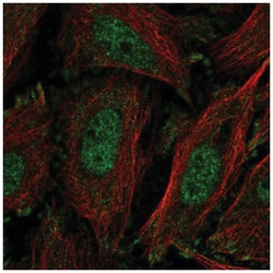 KLF11 Antibody, Novus Biologicals 25 &mu;L, Unlabeled:Antibodies, Polyclonal