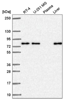 KLHL29 Antibody, Novus Biologicals 100 &mu;L | Buy Online | Novus Biologicals | Fisher Scientific